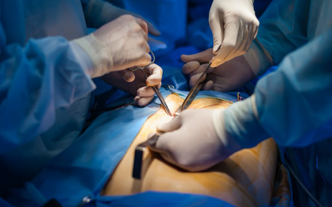 Gallbladder surgeon in patna